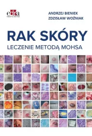 Rak sk�ry. Leczenie metod� Mohsa