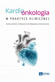 Kardioonkologia w praktyce klinicznej