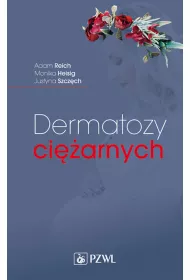 Dermatozy ci�arnych