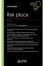 Rak p�uca. Wsp�czesne podej�cie. W gabinecie lekarza specjalisty. Onkologia