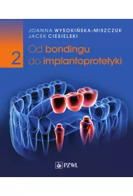 Od bondingu do implantoprotetyki. Cz�� 2