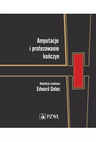 Amputacje i protezowanie ko�czyn