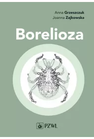 Borelioza