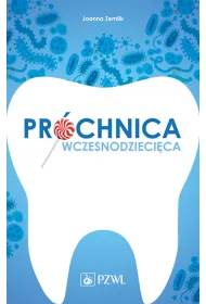 Pr�chnica wczesnodzieci�ca