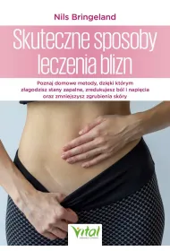 Skuteczne sposoby leczenia blizn