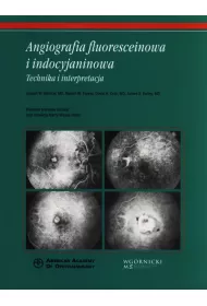 Angiografia fluoresceinowa i indocyjaninowa. Technika i interpretacja