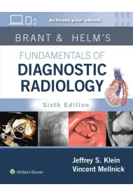 Brant & Helms` Fundamentals of Diagnostic Radiology: Print + eBook with Multimedia