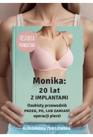 eBook Monika: 20 lat z implantami mobi epub