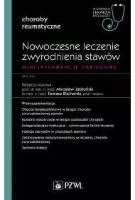 Nowoczesne leczenie zwyrodnienia staww. Mini-interwencje zabiegowe. Choroby reumatyczne. W gabinecie lekarza specjalisty