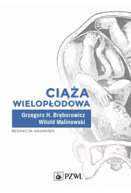 Ci��a wielop�odowa