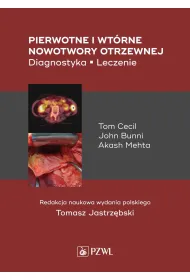 Pierwotne i wt�rne nowotwory otrzewnej