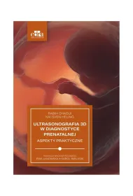 Ultrasonografia 3D w diagnostyce prenatalnej