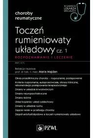 Tocze rumieniowaty ukadowy. Cz 1. Rozpoznawanie i leczenie. Choroby reumatyczne. W gabinecie lekarza specjalisty