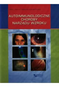 Autoimmunologiczne choroby narz�du wzroku