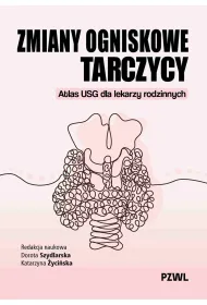 Zmiany ogniskowe tarczycy. Atlas USG dla lekarzy rodzinnych