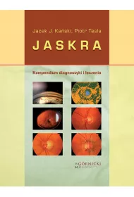 Jaskra. Kompendium diagnostyki i terapii