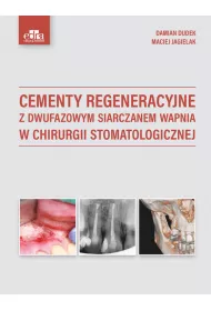 Cementy regeneracyjne z dwufazowym siarczanem wapnia w chirurgii stomatologicznej