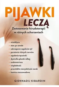 Pijawki lecz�