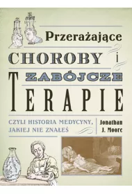 Przera�aj�ce choroby i zab�jcze terapie, czyli historia medycyny, jakiej nie zna�e�