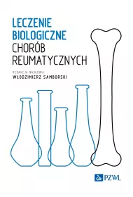Leczenie biologiczne chor�b reumatycznych