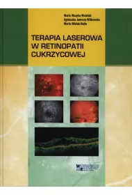 Terapia laserowa w retinopatii cukrzycowej