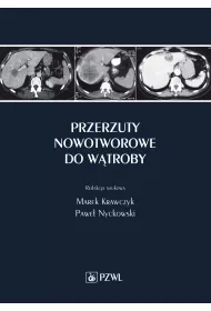 Przerzuty nowotworowe do w�troby