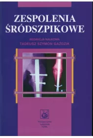 Zespolenia �r�dszpikowe