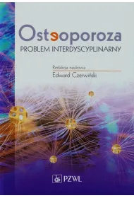 Osteoporoza Problem interdyscyplinarny