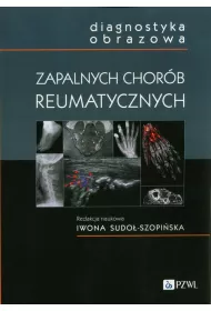 Diagnostyka obrazowa zapalnych chor�b reumatycznych