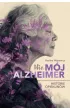 (Nie)m�j alzheimer. Historie opiekun�w